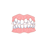 歯のデコボコ イメージ画像